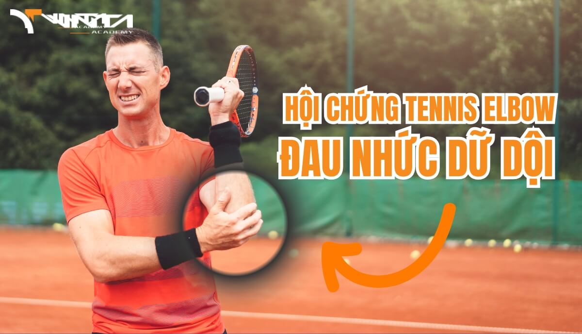 Dấu hiệu nhận biết hội chứng khuỷu tay tennis